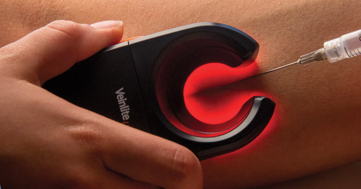 Vein Finder dealers in Chennai